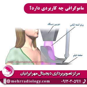 ماموگرافی چه کاربردی دارد؟