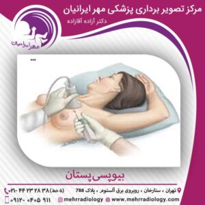 بیوپسی پستان - سونوگرافی مهر ایرانیان
