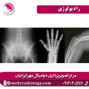 رادیولوژی - مرکز تصویربرداری مهر ایرانیان