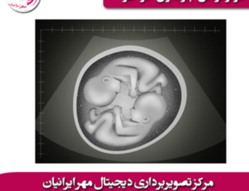 سونوگرافی بارداری دو قلو