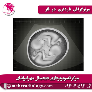 سونوگرافی-بارداری-دو-قلو