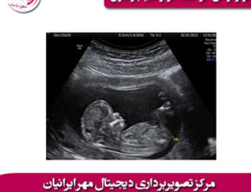 سونوگرافی در هفته دوازدهم بارداری