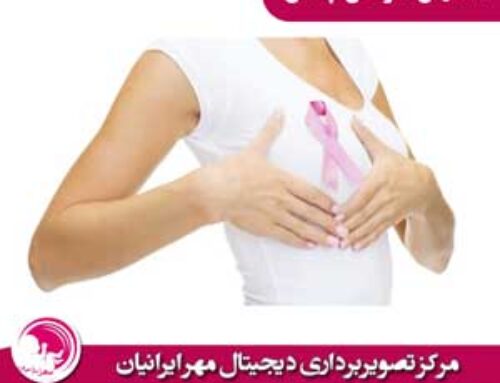 تشخیص سرطان پستان