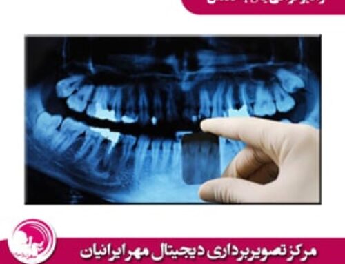 رادیوگرافی یا opg دندان