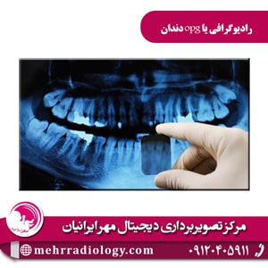 رادیوگرافی یا opg دندان
