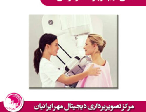 نکاتی مهم درباره ماموگرافی
