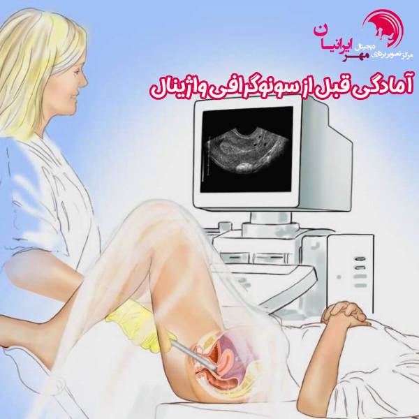 آمادگی قبل از سونوگرافی واژینال