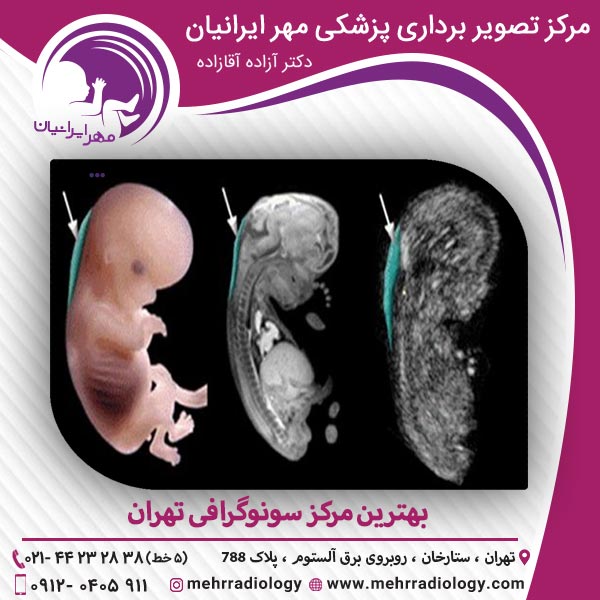 بهترین مرکز سونوگرافی تهران