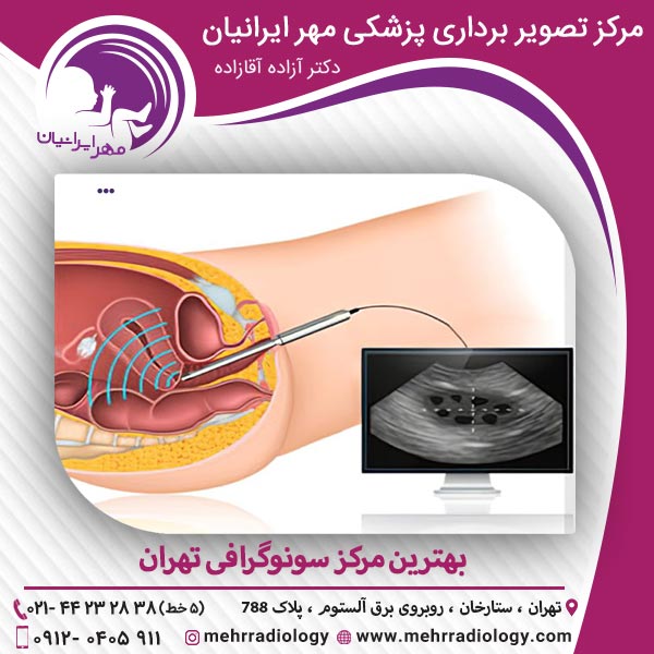 بهترین مرکز سونوگرافی تهران