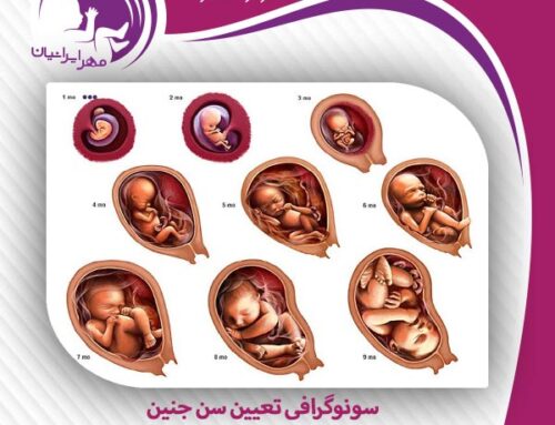سونوگرافی تعیین سن جنین