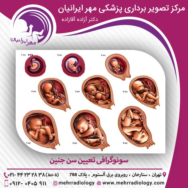 سونوگرافی تعیین سن جنین
