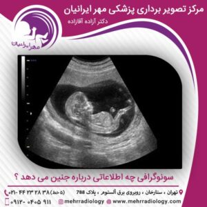 سونوگرافی چه اطلاعاتی درباره جنین می دهد ؟