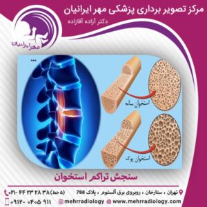 سنجش تراکم استخوان - مرکز تصویربرداری مهر ایرانیان