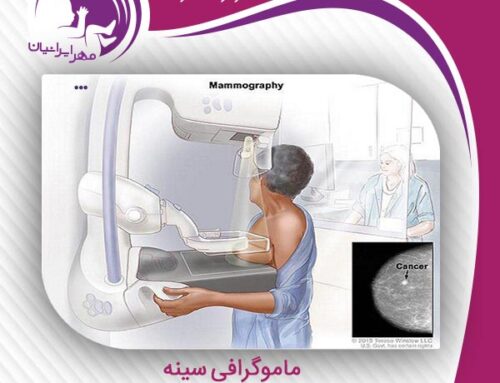 ماموگرافی سینه
