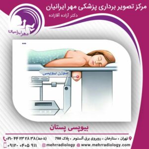 بیوپسی پستان - سونوگرافی مهر ایرانیان