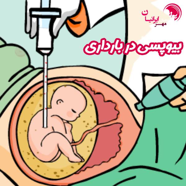 بیوپسی در بارداری