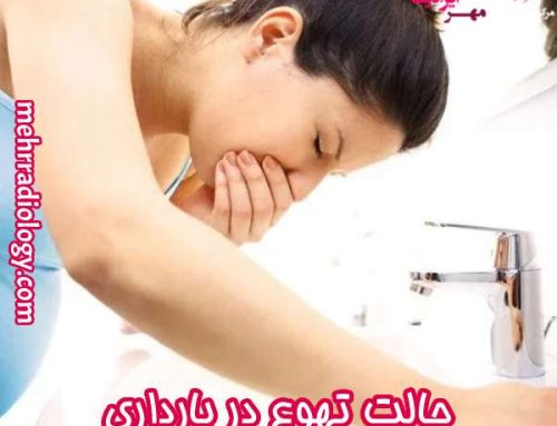 حالت تهوع در بارداری