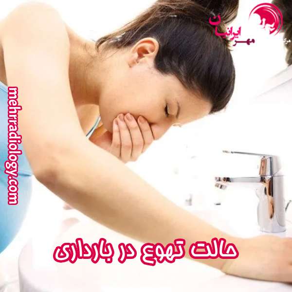 حالت تهوع در بارداری
